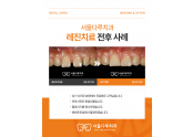 크라운치료 전후 사례
