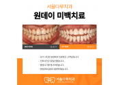 원데이 치아미백 치료사례