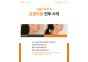 교정치료 치료사례