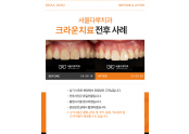크라운 치료사례