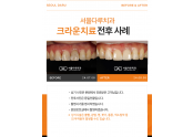 크라운 치료사례